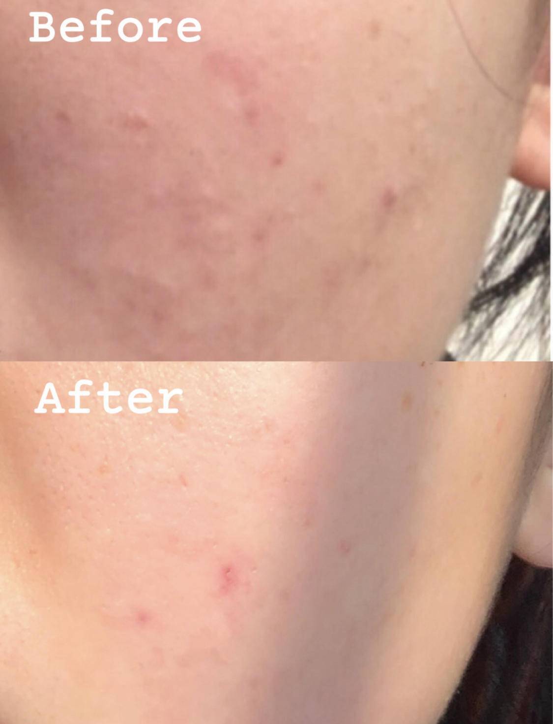 肌肤|别再跟风买了！油皮的【本命水】你喝对了吗？