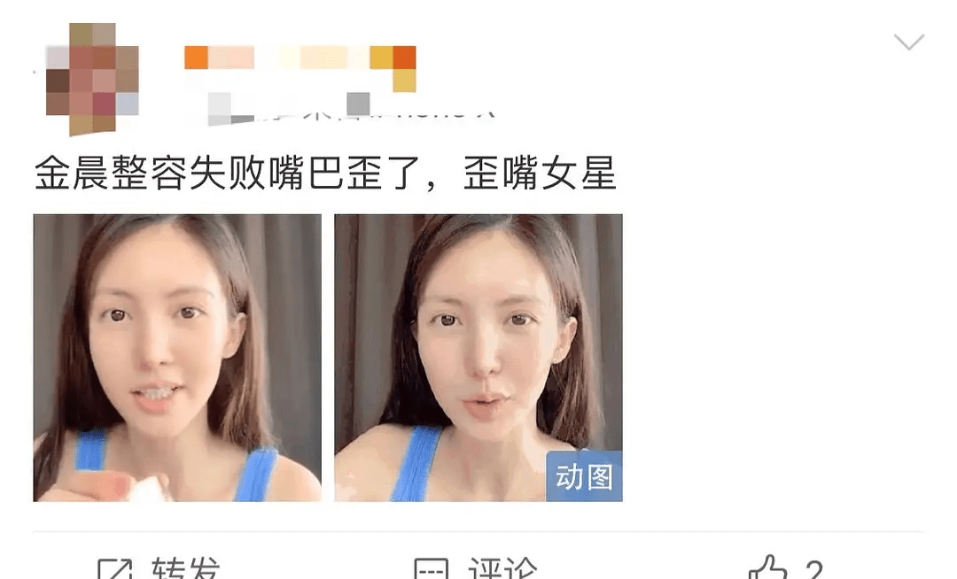 金晨霸气回应歪嘴,天生丽质百毒不侵