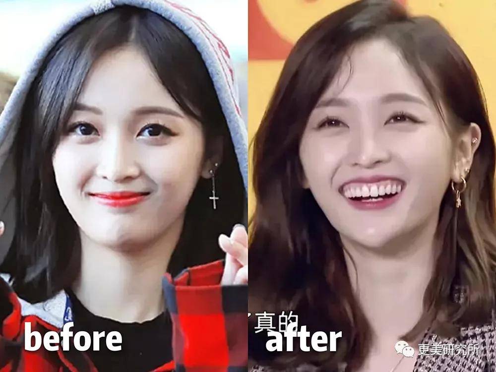 伸缩|蔡徐坤的下巴会自动伸缩？！这是do脸实锤了？