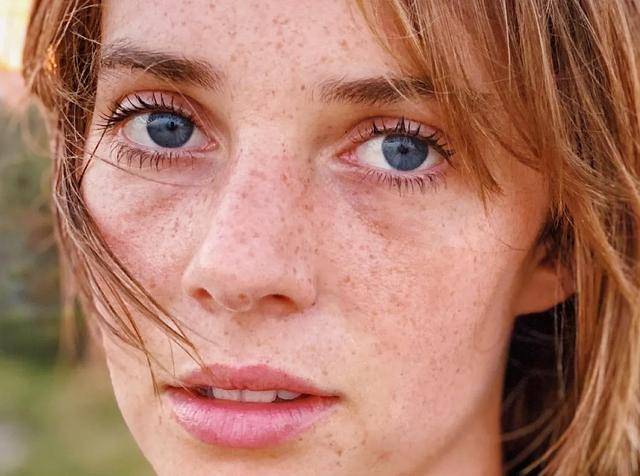 女明星|女明星“眼下增肥”是什么操作？