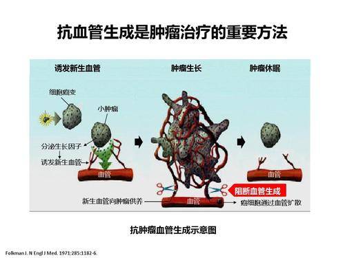 原创抗肿瘤血管生成是什么原理,看完你就豁然开昂都明白了