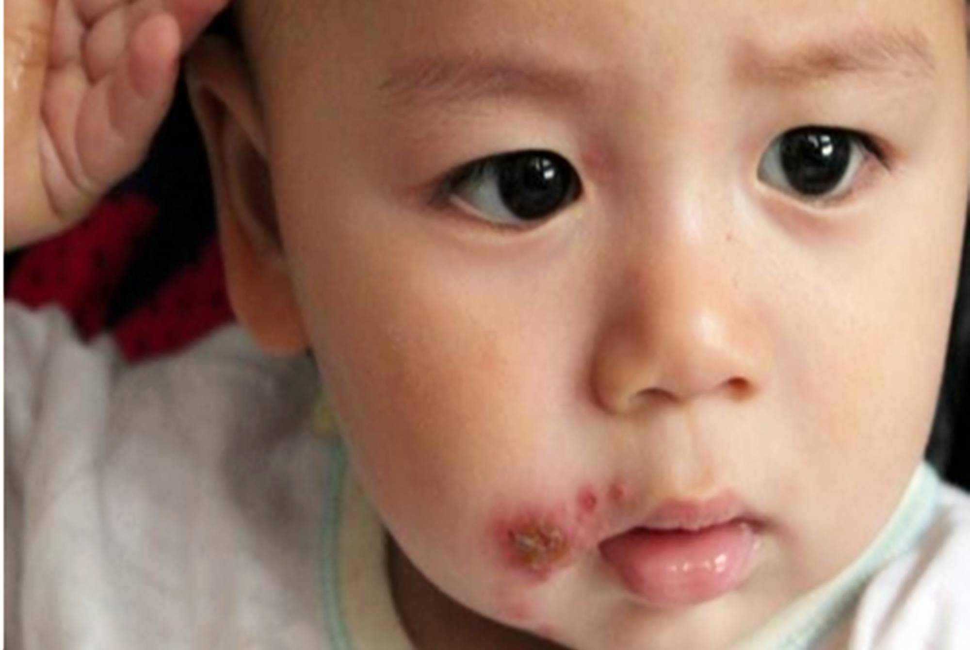 孩子|8岁女孩被父母亲吻患罕见疾病,爱超过范围就是伤害带娃无小事