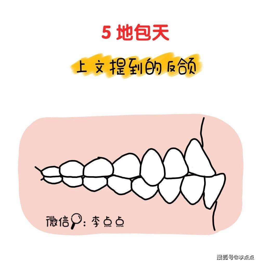 德国|不行！不能让娃长残！我得带他整牙去了