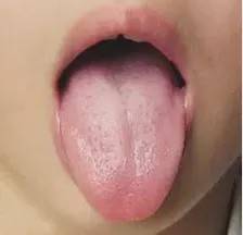 小孩子正常的舌苔是什么样的 b22f81f1dcd3443c8a7167923e151d2b.jpeg