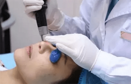 激光皮秒有副作用吗 cc947b40b9674340939b8a7775b073cb.png