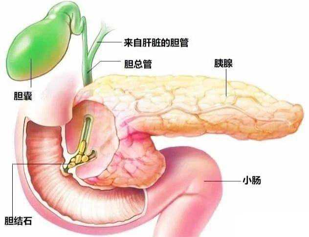 这种疾病很多女性容易患,还可导致更严重的后果_胆囊