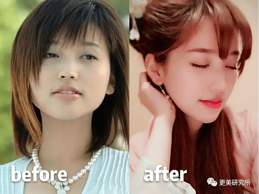 fa|金莎的脸肿成了黄圣依1.5倍，这是又do了？