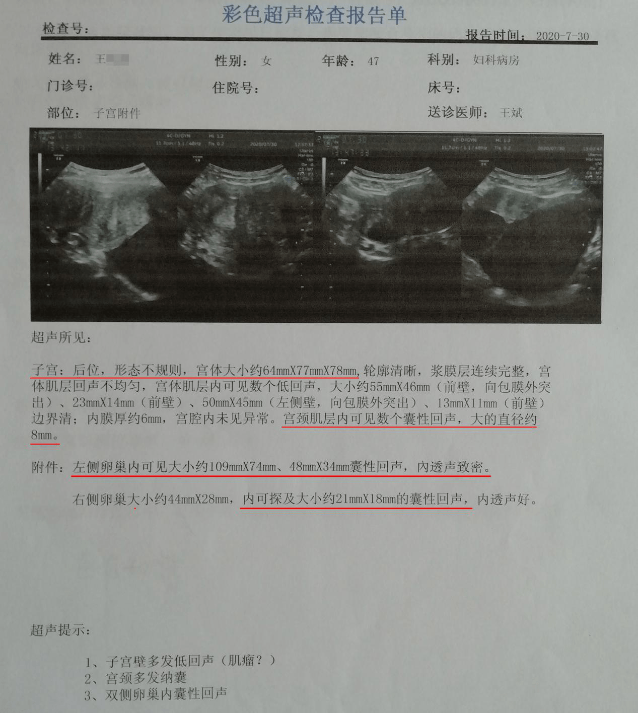 【门诊日记】9年卵巢囊肿,5年子宫肌瘤,北京姐妹在郑州摆脱病痛!