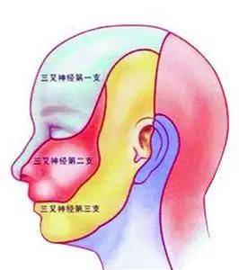 王老伯患三叉神经痛已有3年多了,疼痛以右侧上嘴唇部位为主,以前主要