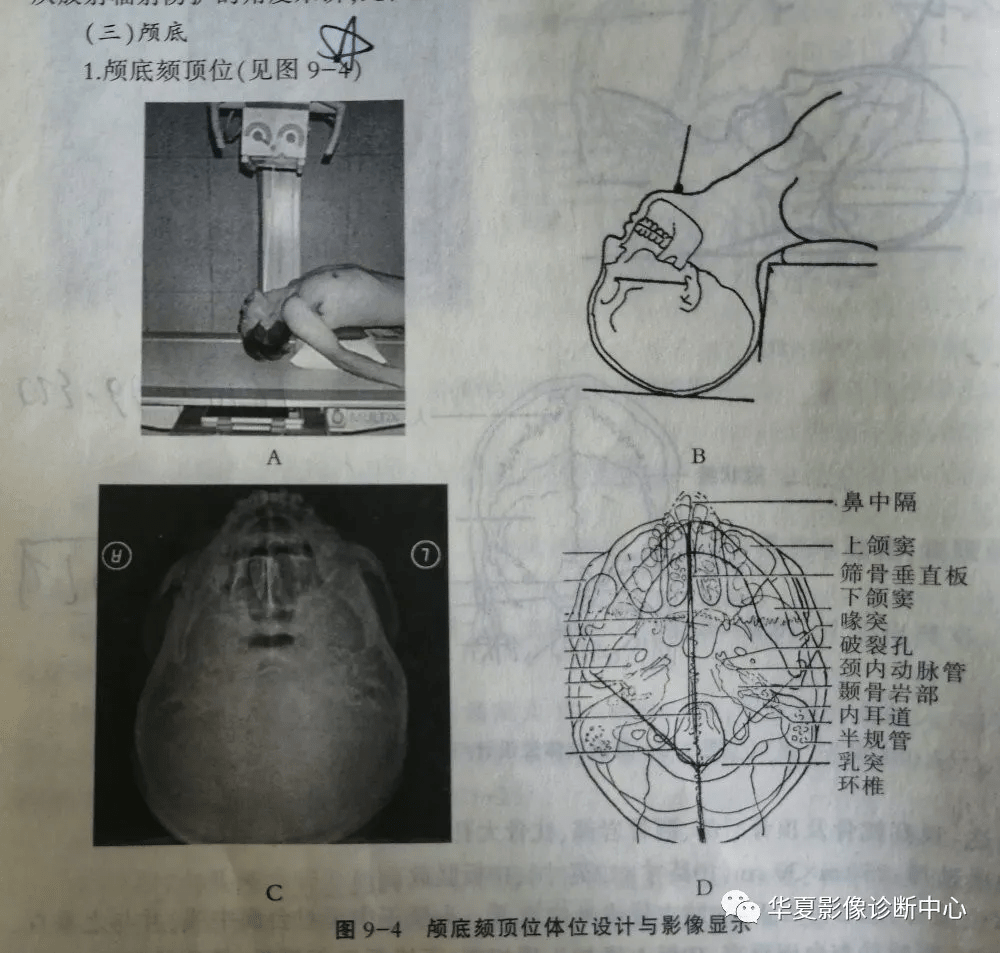 复习几种头颅摄片_手机搜狐网