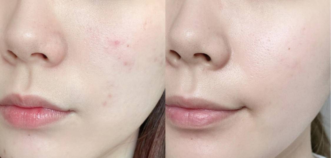 牛奶|20岁让人羡慕的无滤镜牛奶肌，30岁的你也能拥有！