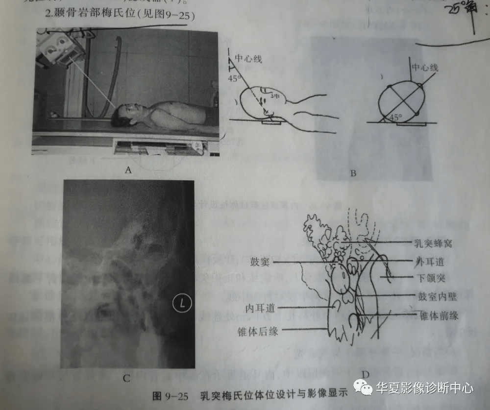 复习几种头颅摄片_体位