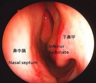 初二学生上课视力突然模糊,检查结果吓坏父母