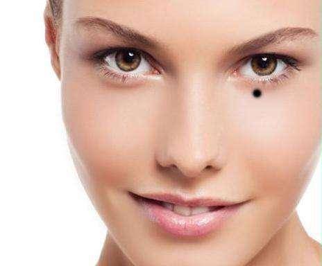 双生痣是好还是不好 5351be9f5d074ebbb1c450b1bc43a4de.jpeg