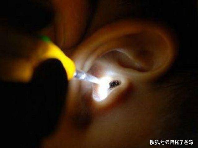 虫子|妈妈第一时间举动救了娃,网友:没少看书3岁儿子耳朵钻进虫子