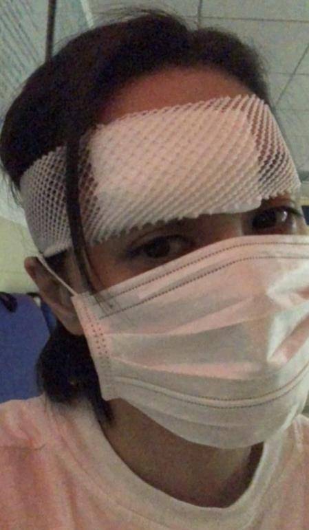 霍汶希晒阿娇受伤照报平安,伤口长达6厘米缝了数十针