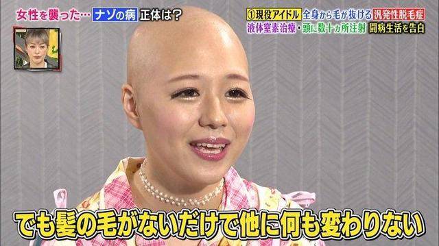 pippi|日本15岁患上“脱毛症”，却意外走上了新人生