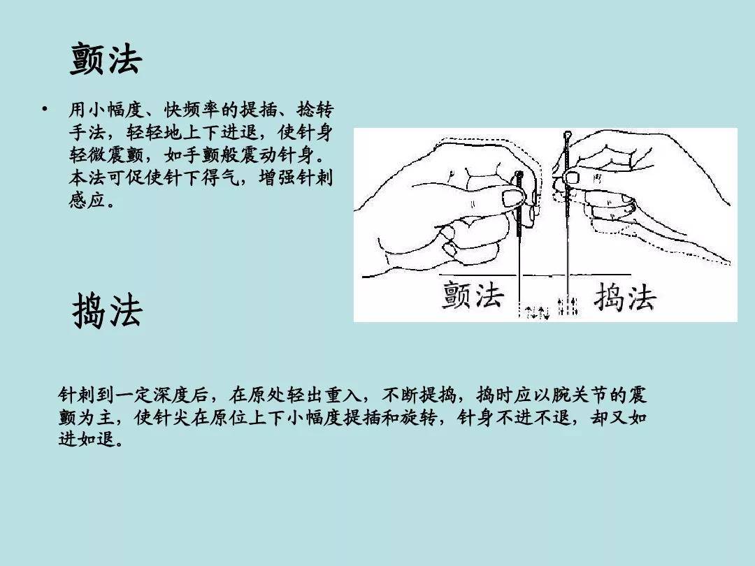中医针灸流程表:持针,进针,行针,出针