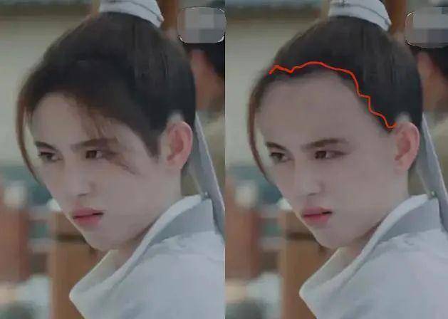 发际线|长得好看都难逃秃头？刘诗诗旧照被扒也秃头，跟杨幂鞠婧祎有一拼