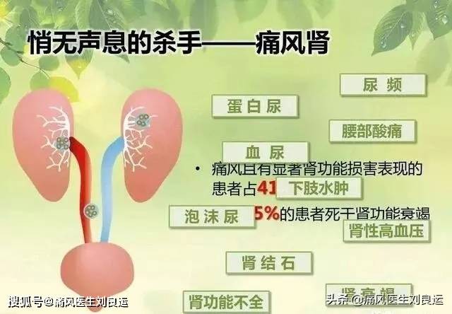 降尿酸的药物对肾伤害大吗 742036ca52574b5fb96d01e101aebbd3.jpeg