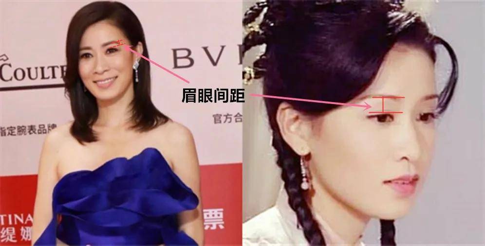 人中|向佐这个强大的长相洼地，真让人担心郭碧婷孩子的颜值