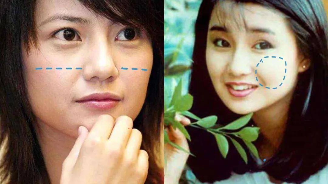 8分|3分到8分，为什么有人是天生适合整容脸?