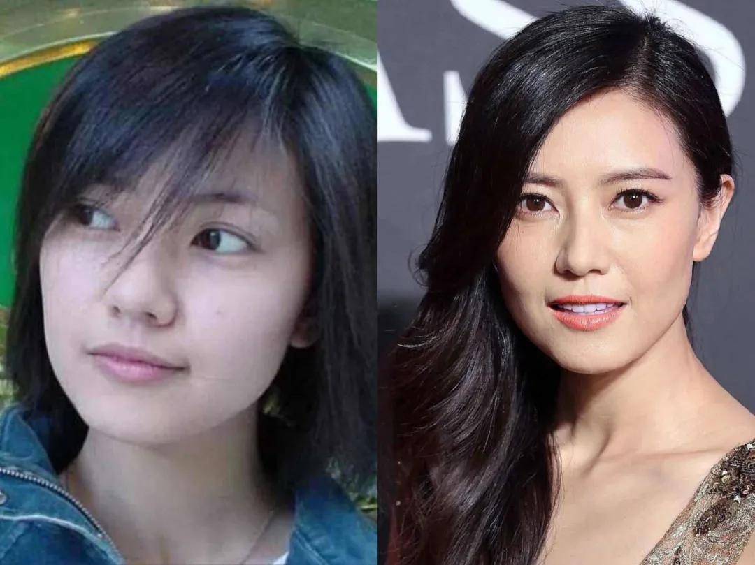 8分|3分到8分，为什么有人是天生适合整容脸?