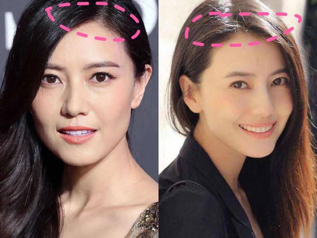 8分|3分到8分，为什么有人是天生适合整容脸?