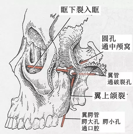 下:翼腭管-腭大,小孔-口腔外:翼上颌裂-颞下窝内:蝶腭孔-鼻腔