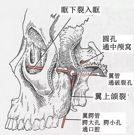 影像解剖:翼腭窝的ct影像解剖_手机搜狐网