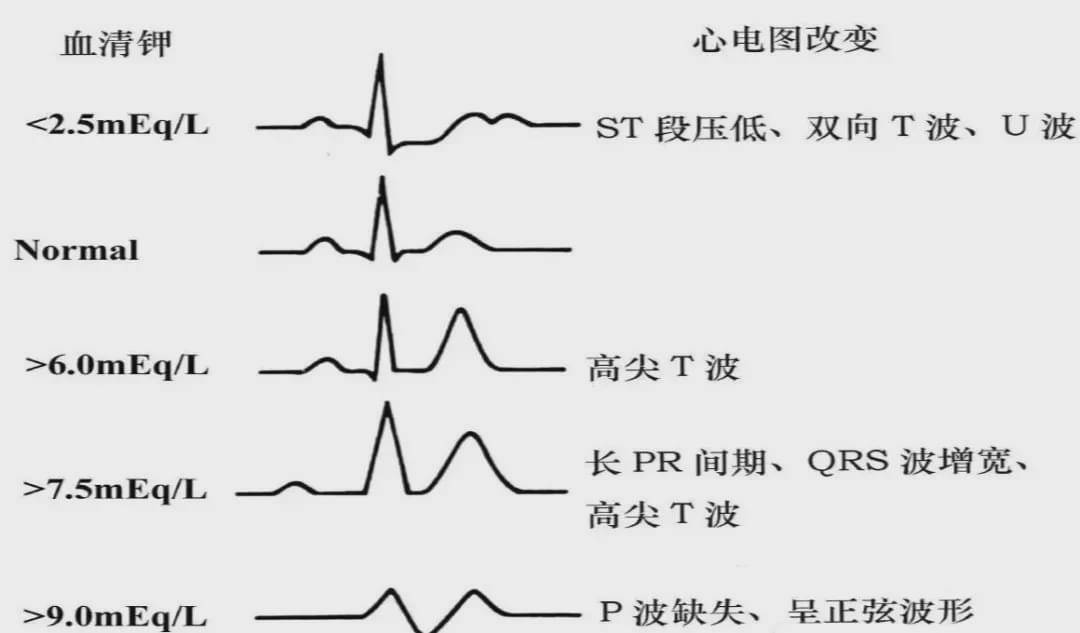 什么东西高钾 abfbf9121e8e4b4b97edef7aea02bb6d.jpeg