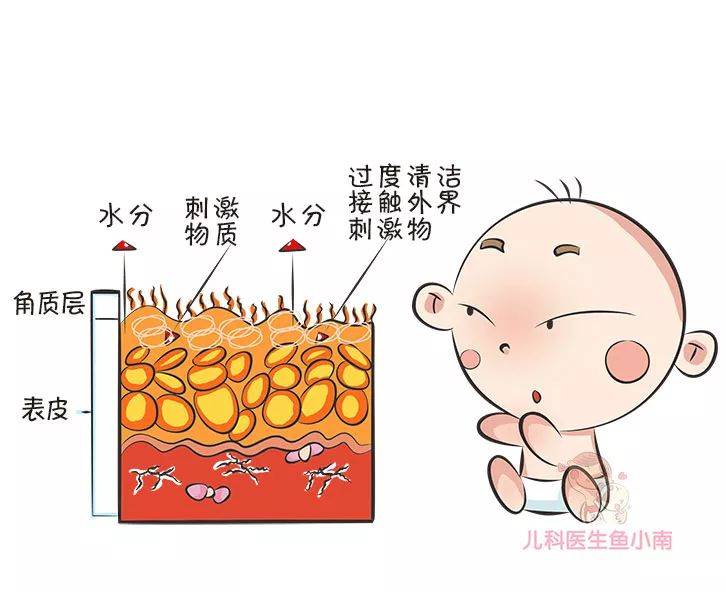 皮肤|医生：首先你必须要分清皮疹湿疹热疹这3种宝宝皮肤问题总反复