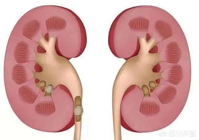 左肾积水怎么回事啊 5121b32344354356afa396a192a7ddeb.jpeg