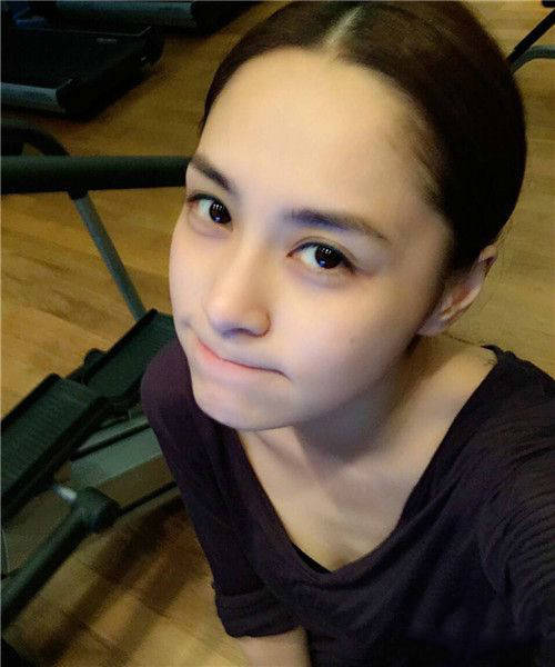 真留疤了！阿娇复工超敬业戴帽子口罩遮遮掩掩