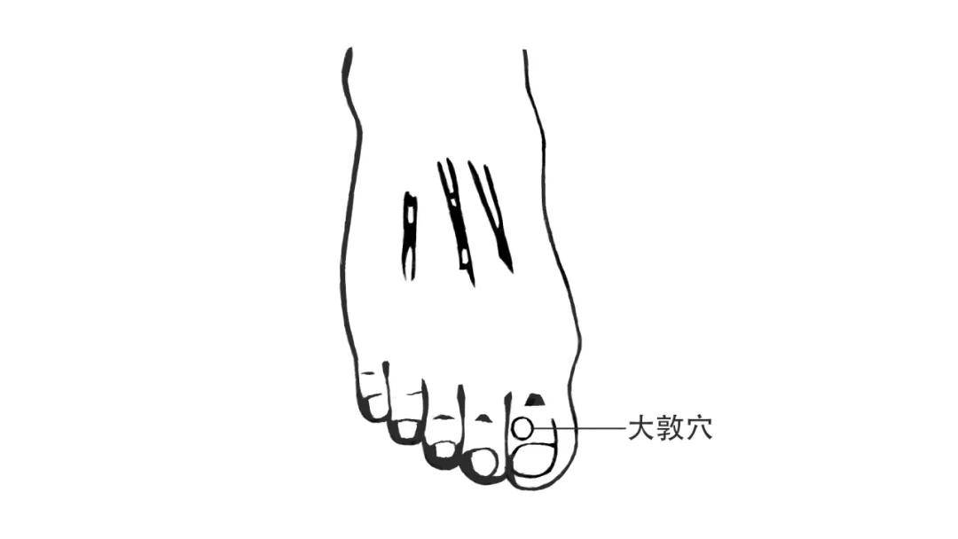 三阴交——疏肝郁,泄肝热取穴内踝尖上3寸,胚骨后缘处.