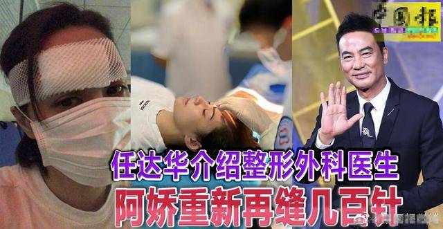 打脸了！阿娇大方晒伤口照，好长缝合线看着好