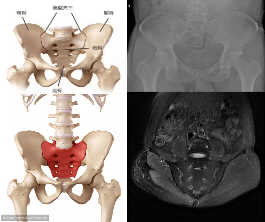 图13 骶骨（后面观）-人体解剖组织学-医学