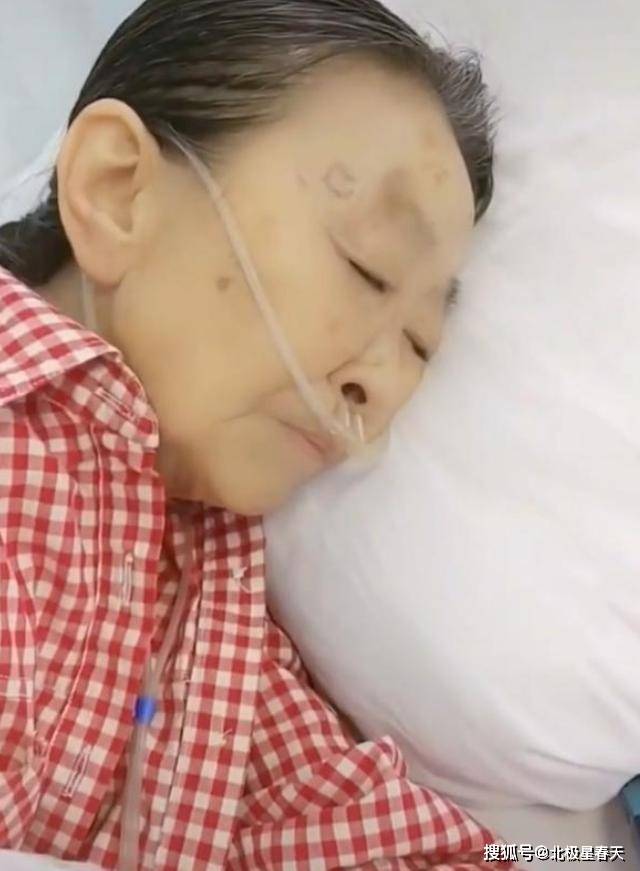 “丑娘”张少华，曾带人抄新凤霞的家，打残其腿，多年后报应来了