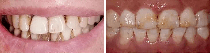 新剧|她新剧开撩，吻戏也就回放 10 来遍吧