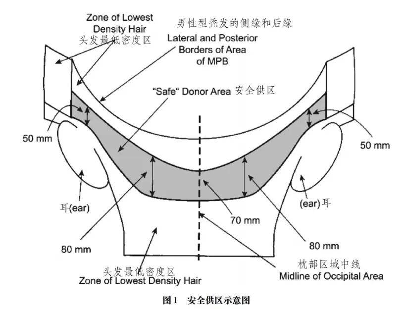 植发|2.5亿人的头顶大事