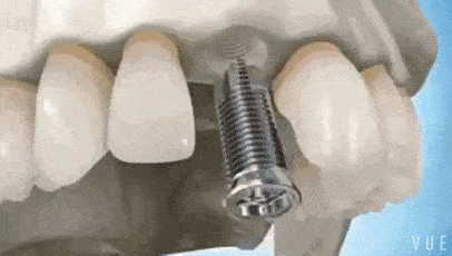 04c8659ac8d348b1bc21c6387c216a03.gif