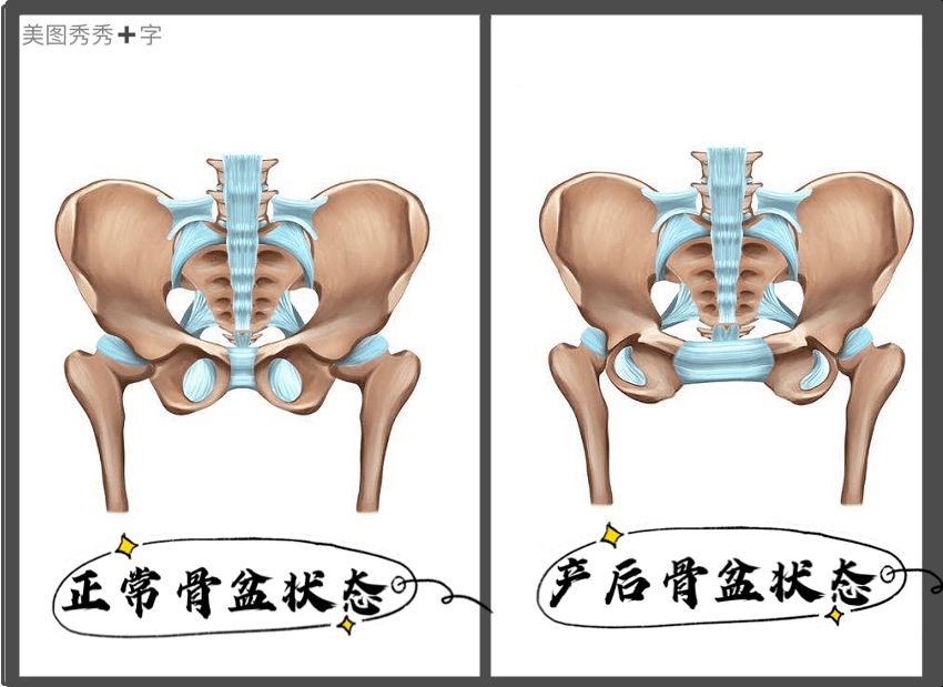 骨盆松弛会出现以下症状:体型走样,腰痛肩酸,步行困难,内脏和子宫下垂