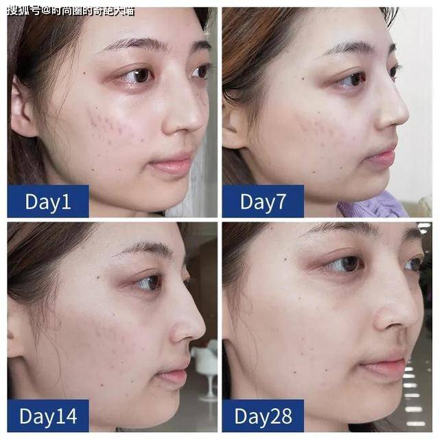 什么|李多海的脸遭遇了什么!坑坑洼洼粉都填不平,没了滤镜颜值太真实