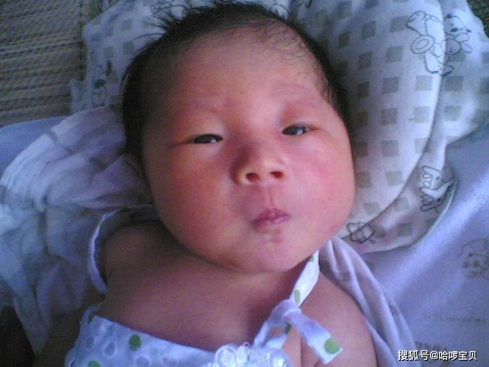 小黄人|没几天就变“小黄人”,是母乳质量不好吗?宝宝刚出生时粉嘟嘟