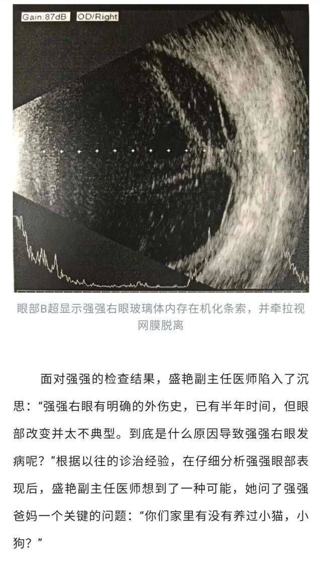什么虫子会钻进眼睛 3adaf7771e2f4b9b842b8cfaaf294cc6.jpeg