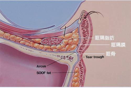 移植|眼眶部网格化分区与脂肪移植