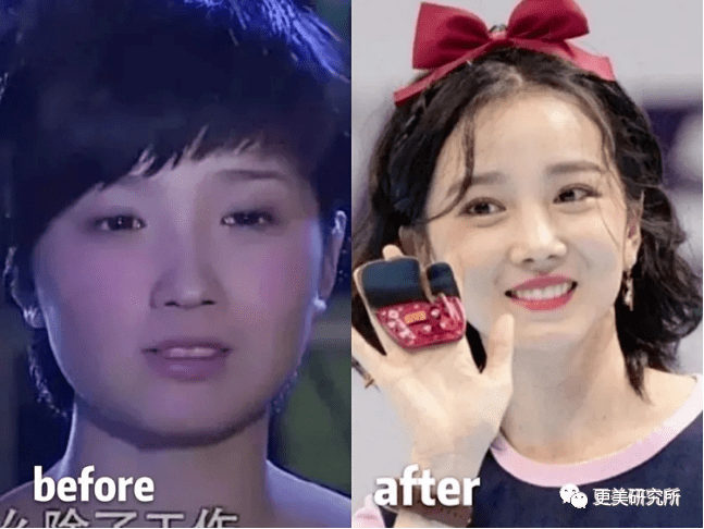 do|贵圈削骨图鉴 | 三代100个女星同时削掉半张脸、杨幂竟还垫底...