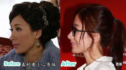 杨怡|曾经tvb一姐，演技一流，也把自己整僵了，假体太明显了...