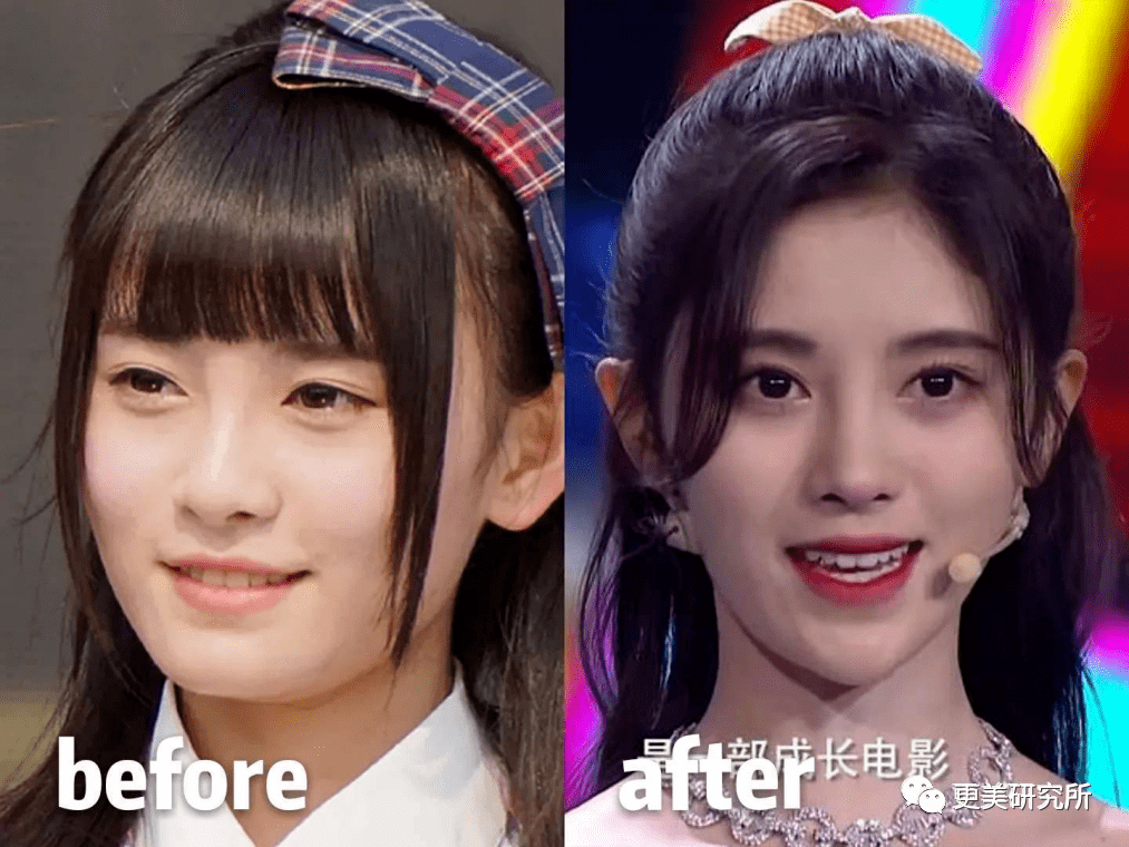 do|贵圈削骨图鉴 | 三代100个女星同时削掉半张脸、杨幂竟还垫底...