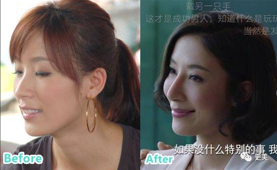 杨怡|曾经tvb一姐，演技一流，也把自己整僵了，假体太明显了...